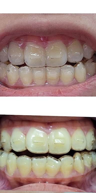 Dr Clear Aligners Dental Clinic
