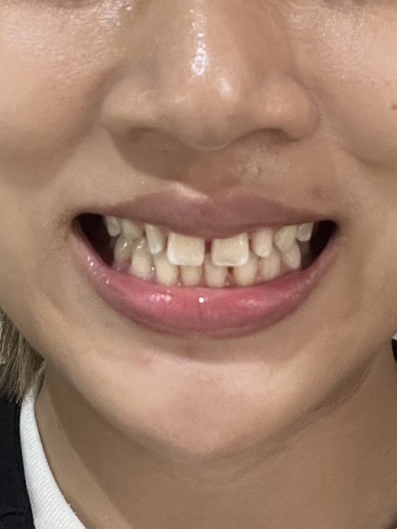 Chidlom Skytrain Dental Clinic